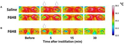 Deciphering the Action of Perfluorohexyloctane Eye Drops to Reduce Ocular Discomfort and Pain